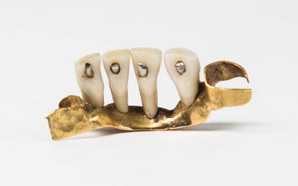 Muitas das dentaduras dos séculos 18 e 19 foram feitas com os dentes dos soldados mortos em Waterloo 10