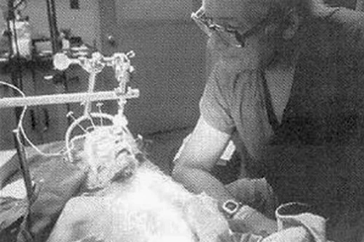 O que um experimento de 1970 revela sobre os perigos dos 'transplantes de cabeça'
