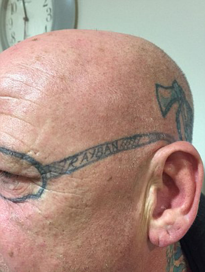 Depois de um porre, homem acordou com um culos de sol Ray-Ban tatuado no rosto