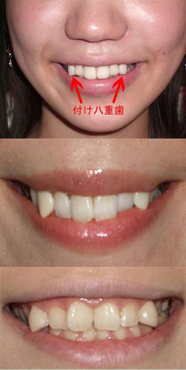 Moda dos dentes tortos no Japo 08