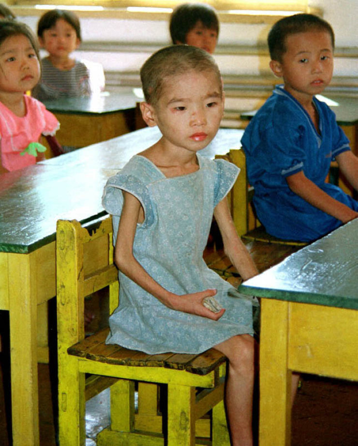 A desnutrio infantil na Coria do Norte em uma fotografia