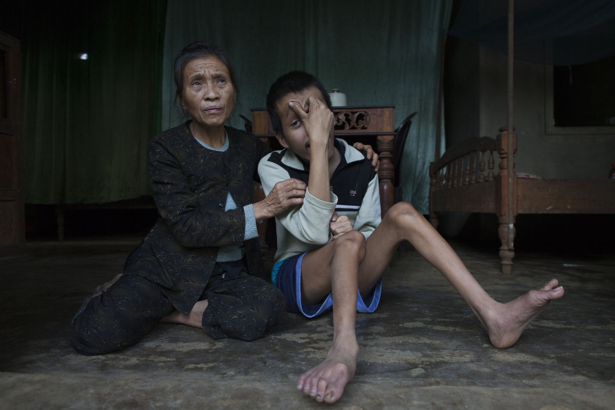 Estas 12 fotos mostram o legado devastador dos Estados Unidos no Vietnã 09