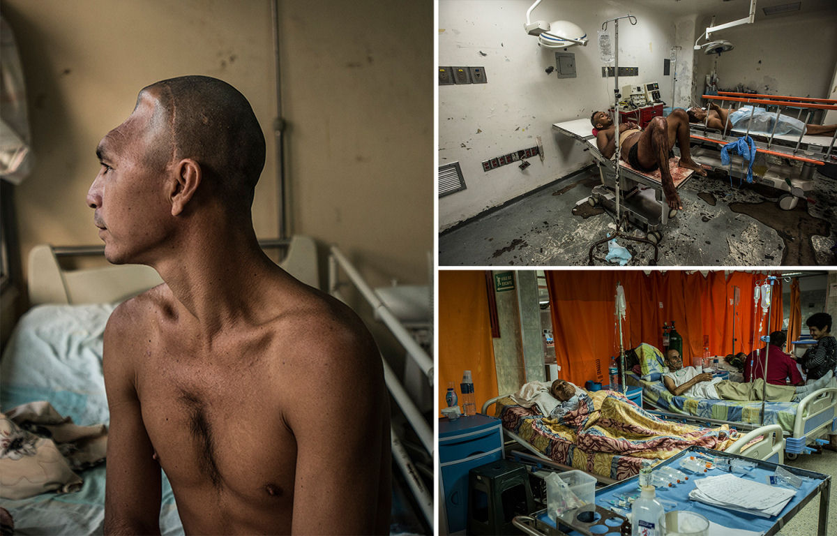 Estas fotos devastadoras mostram o estado dos hospitais da Venezuela em crise 01