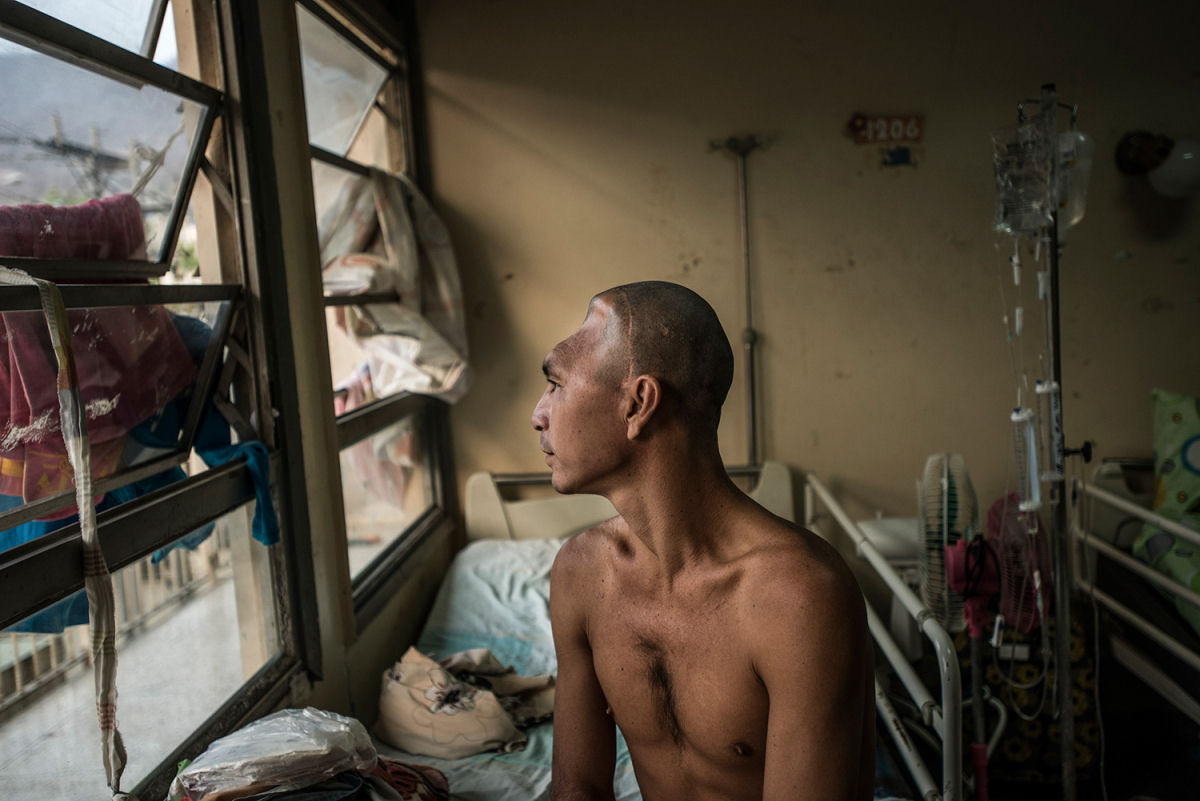Estas fotos devastadoras mostram o estado dos hospitais da Venezuela em crise 09