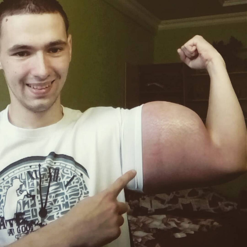 Popeye russo: o jovem fisiculturista que injetou leo nos braos 05