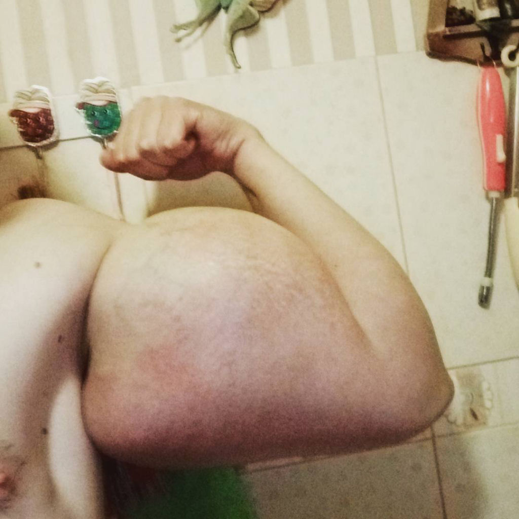 Popeye russo: o jovem fisiculturista que injetou leo nos braos 07