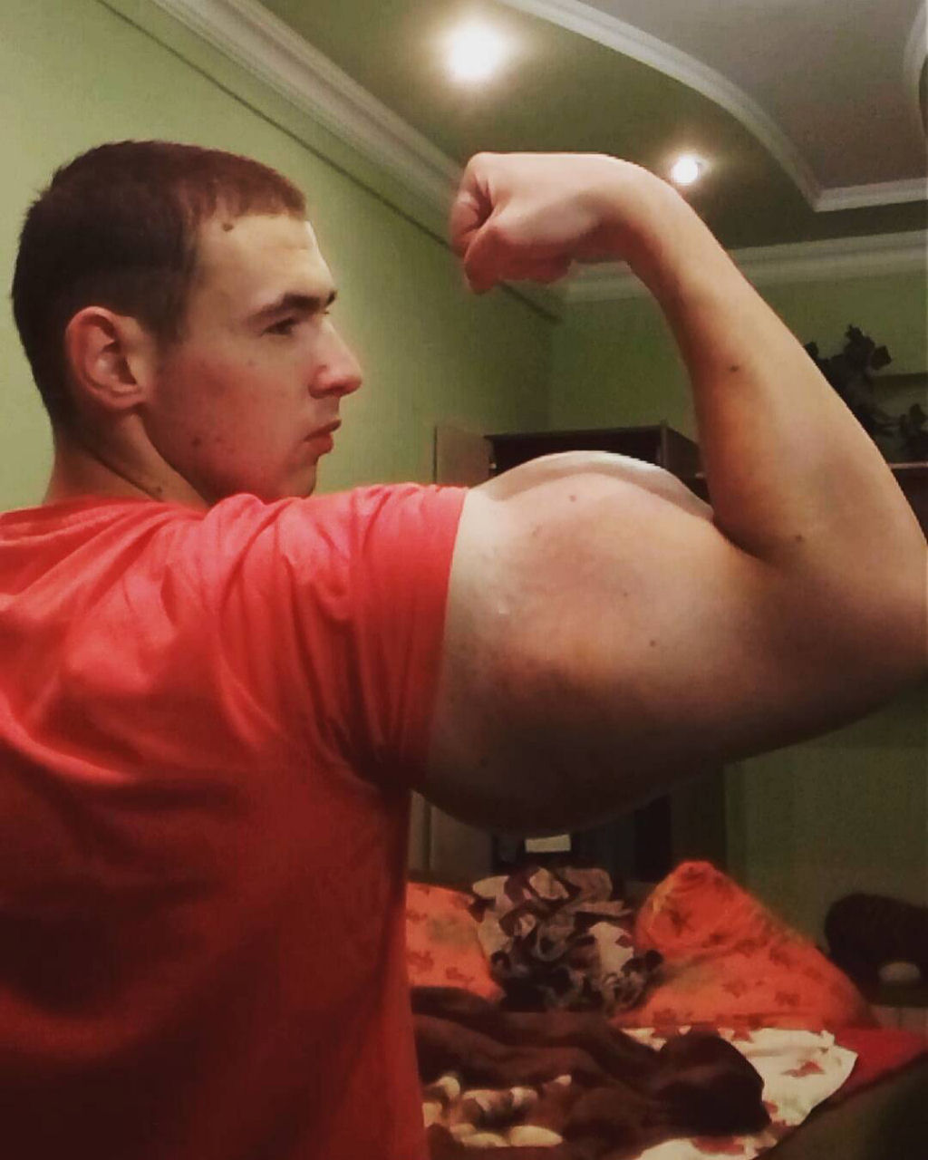 Popeye russo: o jovem fisiculturista que injetou leo nos braos 09