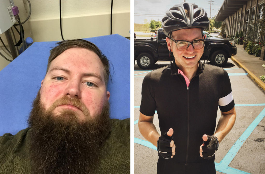 Fotos do antes e depois mostram incríveis mudanças físicas da vida sem álcool 02