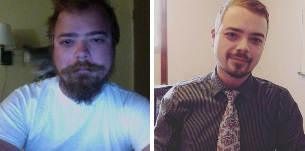Fotos do antes e depois mostram incríveis mudanças físicas da vida sem álcool 06