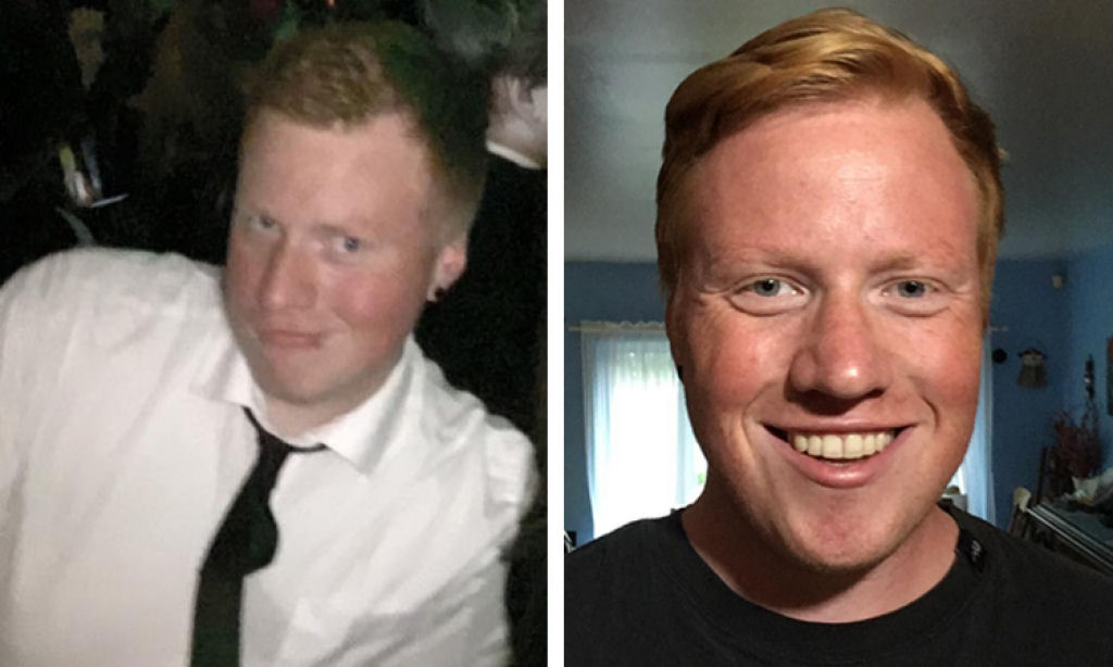 Fotos do antes e depois mostram incríveis mudanças físicas da vida sem álcool 10
