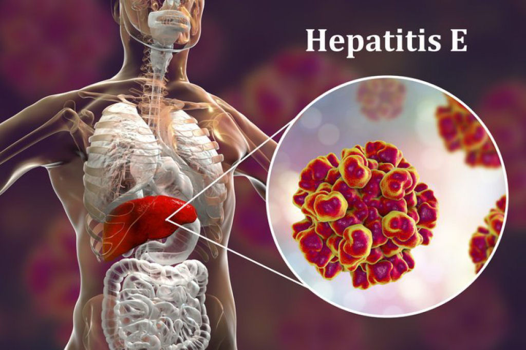 Ao menos 11 pessoas em Hong Kong estão infectadas com uma nova cepa da hepatite E, transmitida por ratos e ninguém sabe como