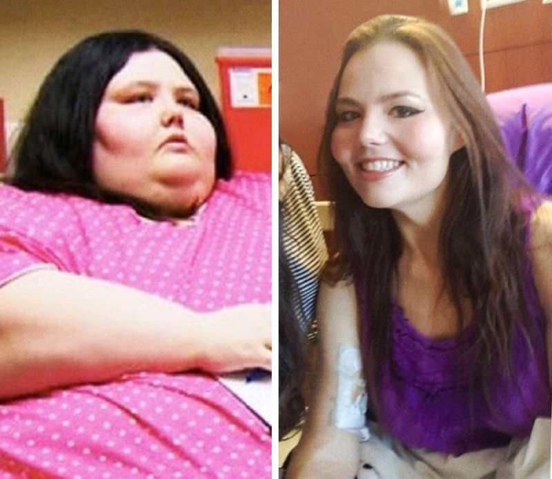 O antes e o depois destas justaposições de perda de peso parecem mostrar pessoas totalmente diferentes 08
