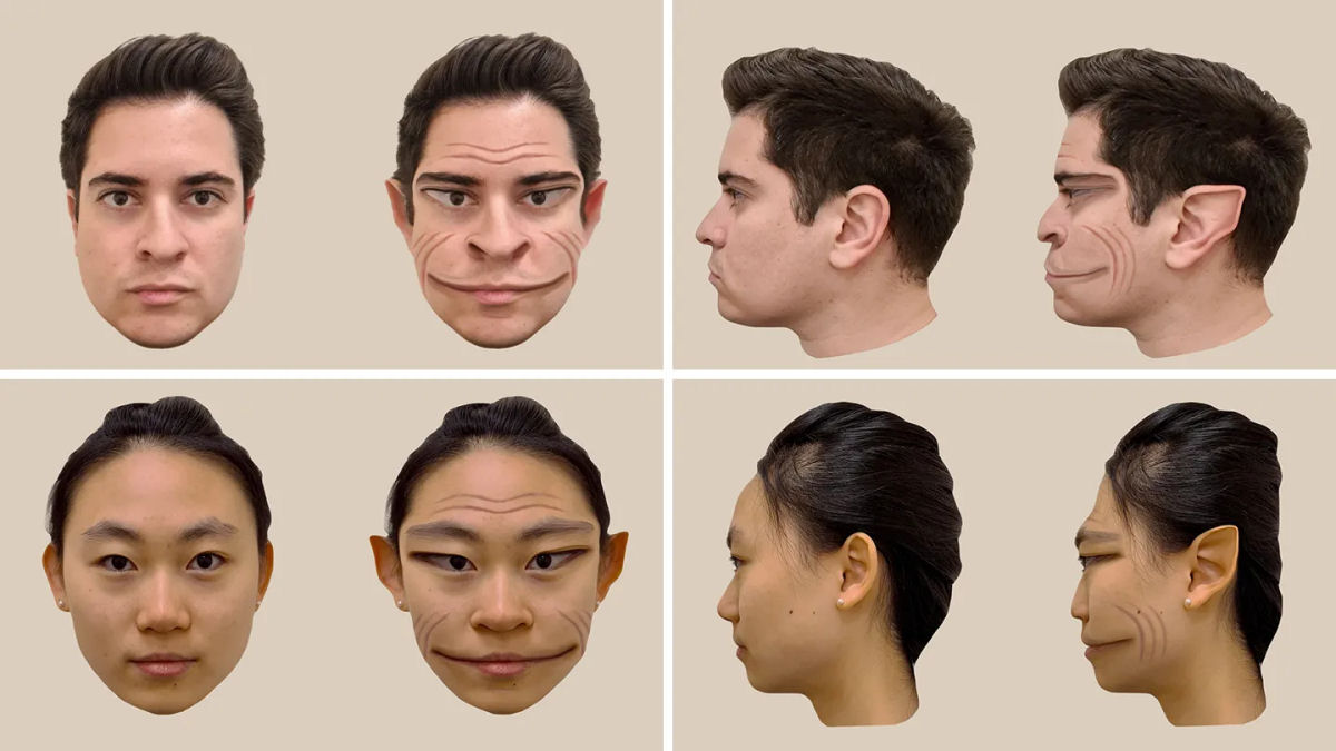 Condio neurolgica extremamente rara faz com que os rostos paream distorcidos ou como um demnio