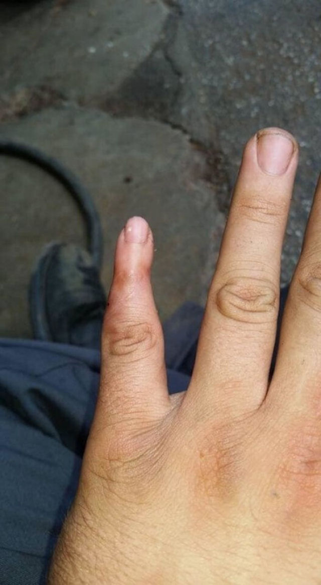 Este dedo esqueceu de crescer.
