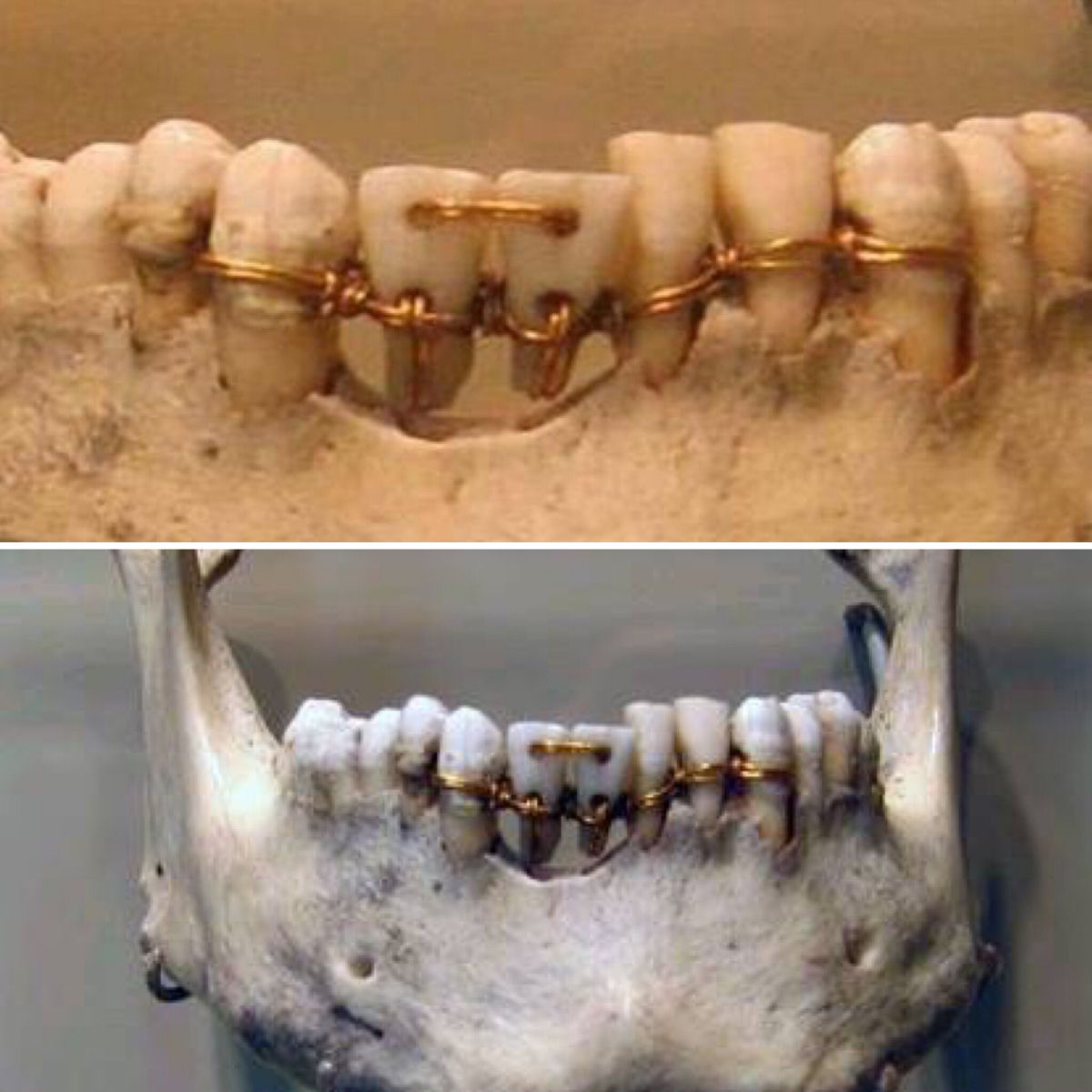 Obra dentária egípcia antiga de 2.000 a.C.