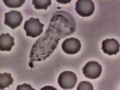 Um glóbulo branco à caça de uma bactéria