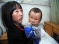 Garoto chinês nasce com estranha máscara 