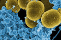 Superbactéria preocupa comunidade médica mundial