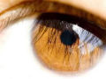 Médico promete transformar olhos castanhos em azuis por 5 mil dólares