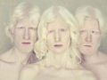 Albinos, um belo trabalho de fotografia