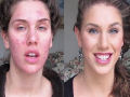 Adolescente que cobre a acne com maquiagem se torna uma sensação no YouTube