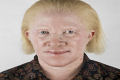 Os albinos são assassinados na Tanzânia devido à boa sorte que dão