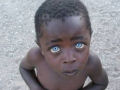 A cor dos olhos deste garoto surpreendeu o mundo