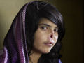 Um novo nariz para Aisha, a jovem que desafiou ao Islã