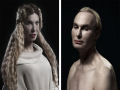 Plástica beleza: retratos de pessoas com cirurgia estética extrema