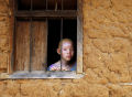 Albinos da Tanzânia vivem em constante ameaça de ataque