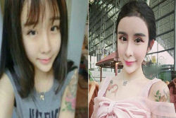 Uma adolescente chinesa recorre à cirurgia estética extrema por amor
