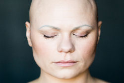 7 retratos impressionantes de mulheres com alopecia redefinem a feminilidade