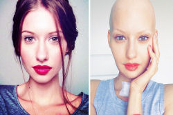 Mulher volta a modelagem depois de perder sua mabíbula para o câncer