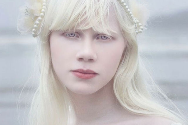 22 pessoas albinas que vo hipnotiz-lo com sua beleza de outro mundo