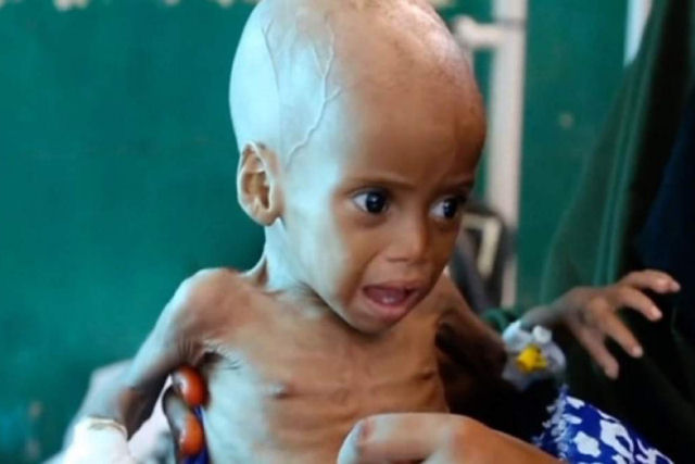 A BBC mostra a agonia de milhares de crianças no mundo, que não têm forças nem para chorar