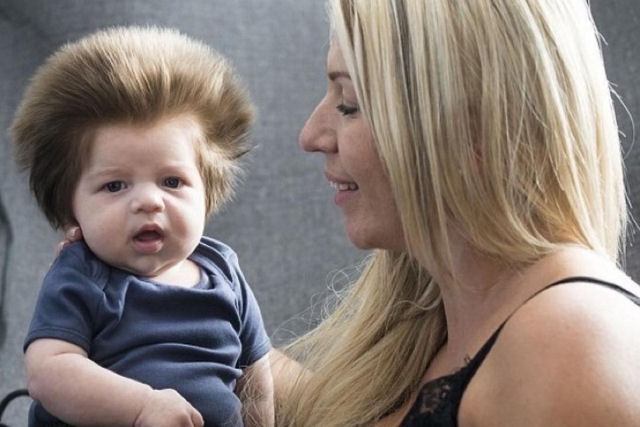 Lembra do bebê maios cabeludo do mundo? Veja como ele está hoje