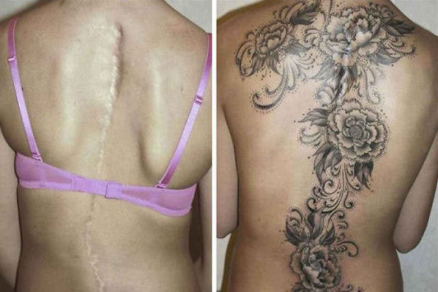 Tatuagens incríveis que cobrem cicatrizes