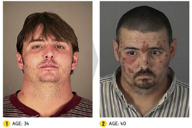 As desagradáveis e terríveis fotos de pessoas antes e depois que as drogas entraram em suas vidas