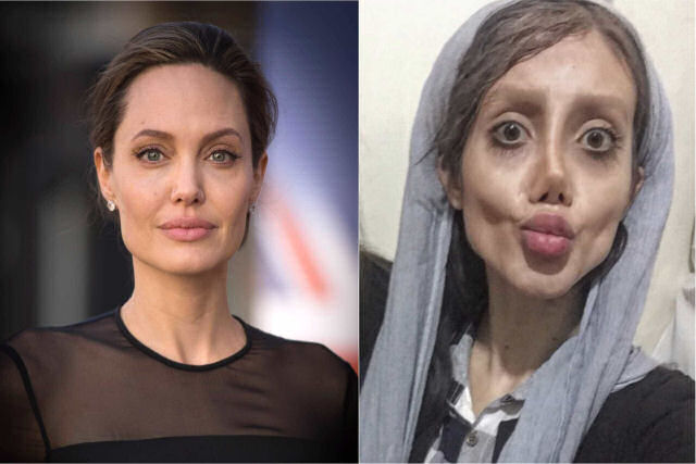 Queria ficar como Angelina Jolie e conseguiu: igualzinha a ela depois de morta e enterrada