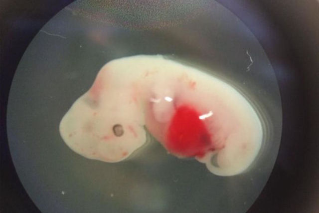Criam pela primeira vez embries humano-ovelha em laboratrio para cultivar rgos humanos
