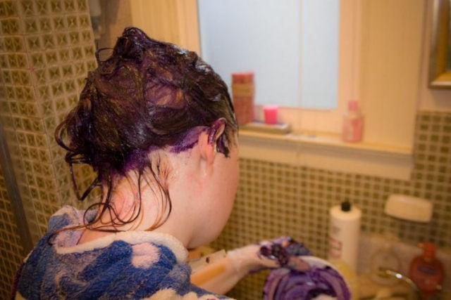Mulher sofre srios danos no fgado por tingir seu cabelo todos os meses por 10 anos