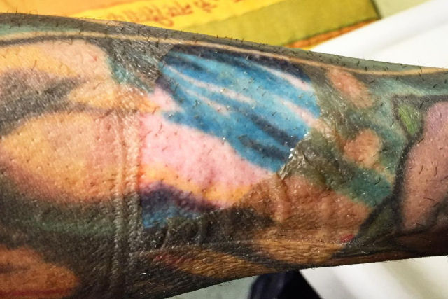 Foto de uma tatuagem vibrante na caamda inferior da pele desperta a controvrsia on-line