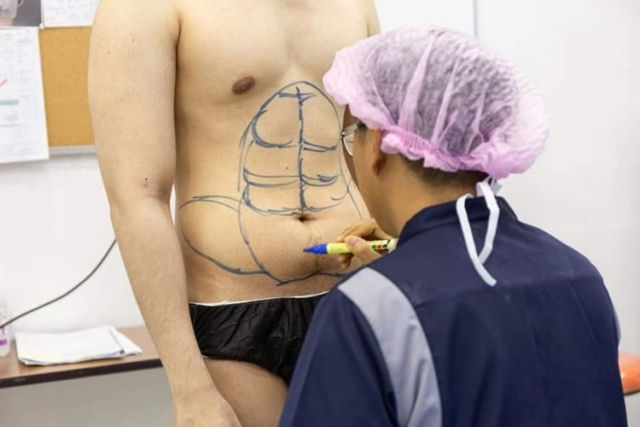 Hospital tailandês tem um procedimento estético que proporciona uma barriga tanquinho ao instante