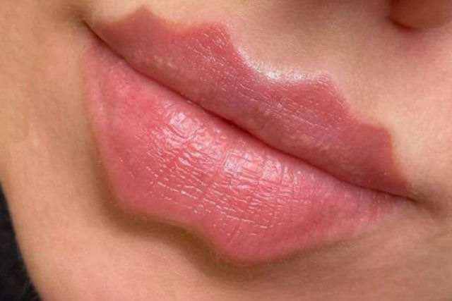 Tendência de beleza bizarra faz garotas russas enlouquecerem por lábios ondulados