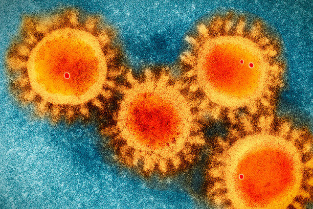 Cientistas confirmam que o novo coronavírus é de origem natural. A grande pergunta segue sendo outra