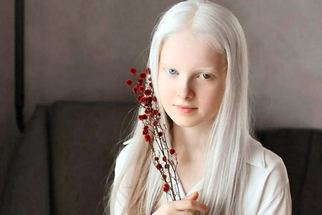 Garota chechena atordoa a Internet com sua beleza sobrenatural