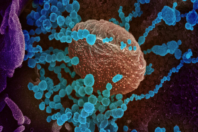 Cientistas revelam uma das coisas mais estranhas do novo coronavírus