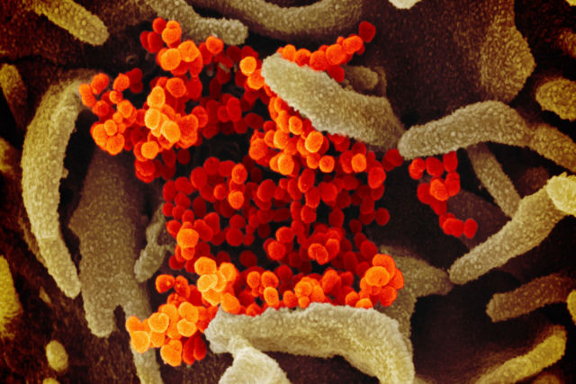 Registrada a primeira morte causada por reinfecção de coronavírus