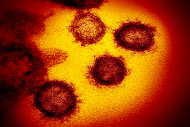 Cientistas acham o ponto fraco do coronavírus graças a um anticorpo de uma infecção de 2003