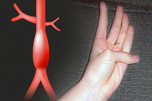 Como saber se padecemos uma condição cardiovascular grave movendo apenas um dedo